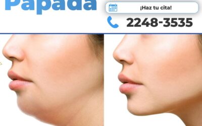 ¿Sabías que el slim láser no solo es para el abdomen?