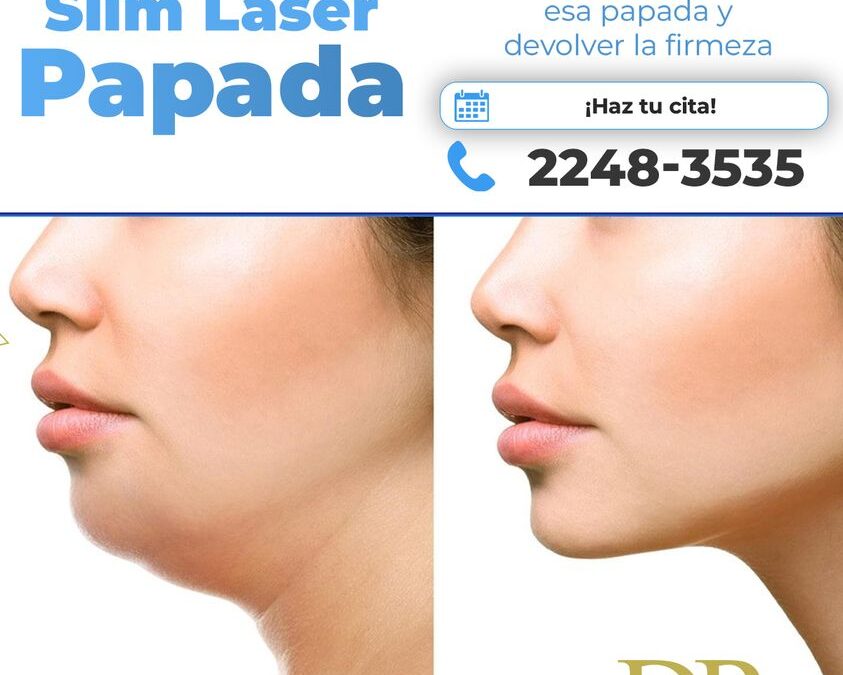 ¿Sabías que el slim láser no solo es para el abdomen?