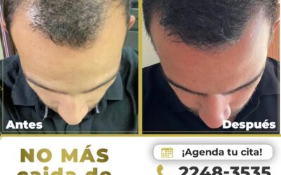 No perdás más cabello