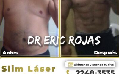 ¿Sabías que el slim láser puede mejorar totalmente tu apariencia?