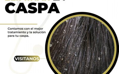 Elimina la caspa de una vez por todas, con nuestros productos 100% efectivos.