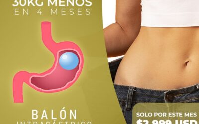 Balón intragástrico sin cirugía.