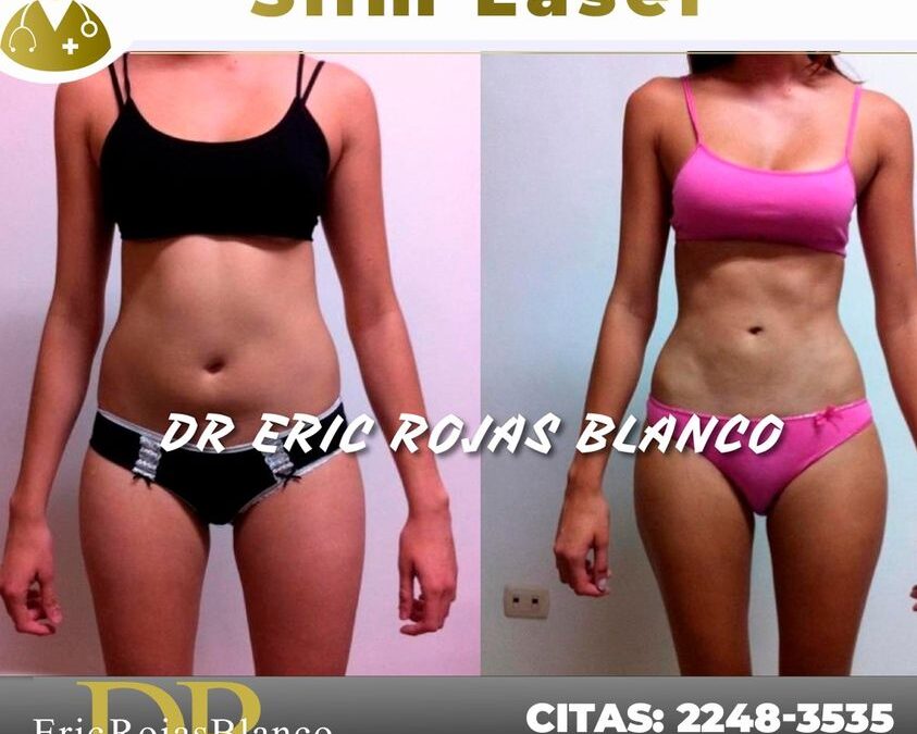 Slim Láser, increíbles resultados en nuestros pacientes, ¿Qué esperas para obtener tu cambio?