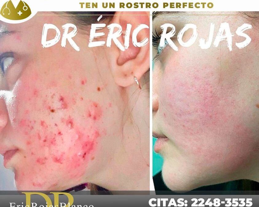 Mira este increíble cambio en nuestra paciente, vuelve a tener tu rostro perfecto