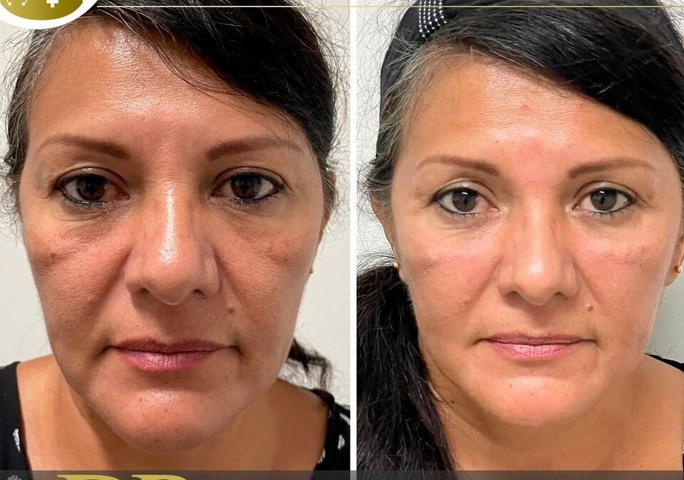 Devolvemos tu sonrisa con nuestros procedimientos