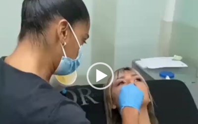 Relleno de labios, dale volumen a tus labios. ¡Nosotros podemos mejorarlo!