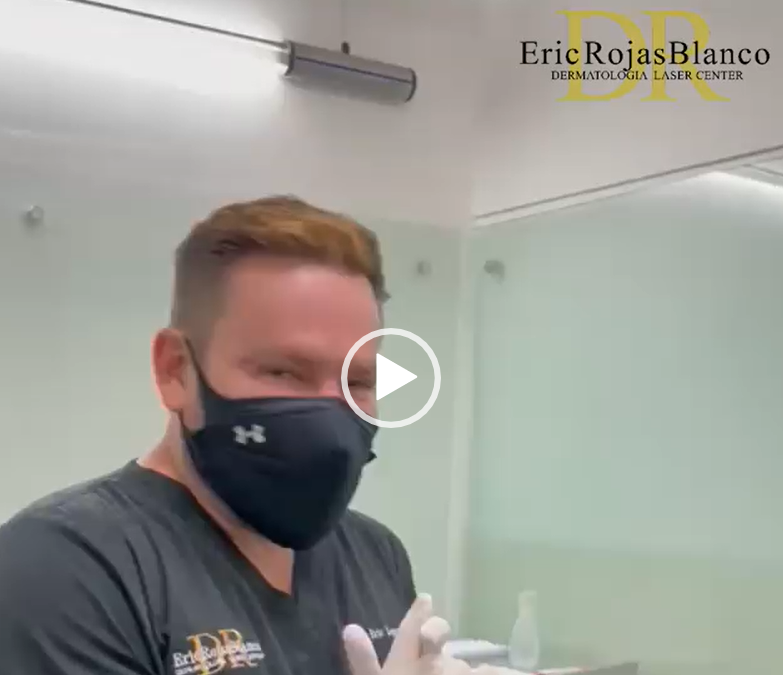 Así lucen los resultados de dermo otoplastia en nuestro paciente luego de una semana de recuperación.