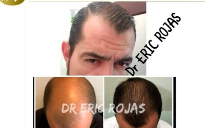 Recupera tu cabello con el mejor tratamiento.
