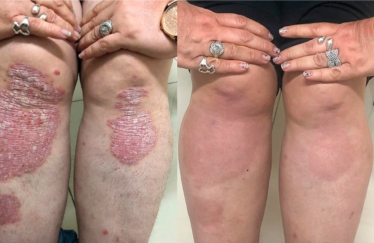 Cuidamos tu piel, somos expertos en piel.