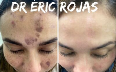 Limpiamos y curamos tu rostro, con los mejores tratamientos del país.  📲 Agenda tu cita virtual: +506 6179-3535