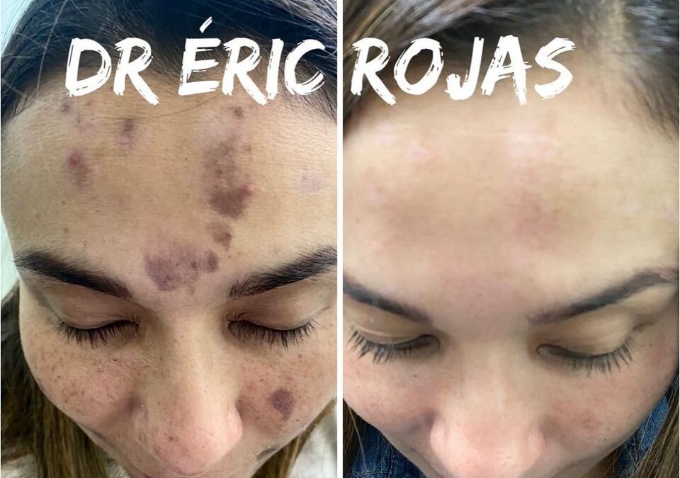 Limpiamos y curamos tu rostro, con los mejores tratamientos del país.  📲 Agenda tu cita virtual: +506 6179-3535