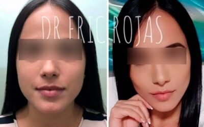 Perfilado Facial, lo mejor para definir tu rostro.