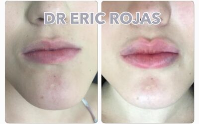 Luce unos labios carnosos, modelado sutil de labios.