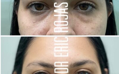 Limpiamos tu rostro.