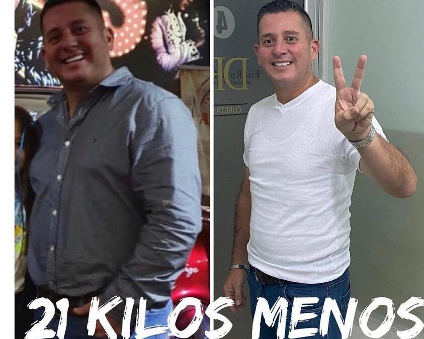 Pierde peso con el mejor procedimiento, ¿Qué esperas para realizar tu cambio este año?