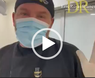 Mira la increíble diferencia entre un brazo tratado con Slim Láser y uno que no.