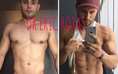 Puedes marcar tu cuerpo con Slim Láser.