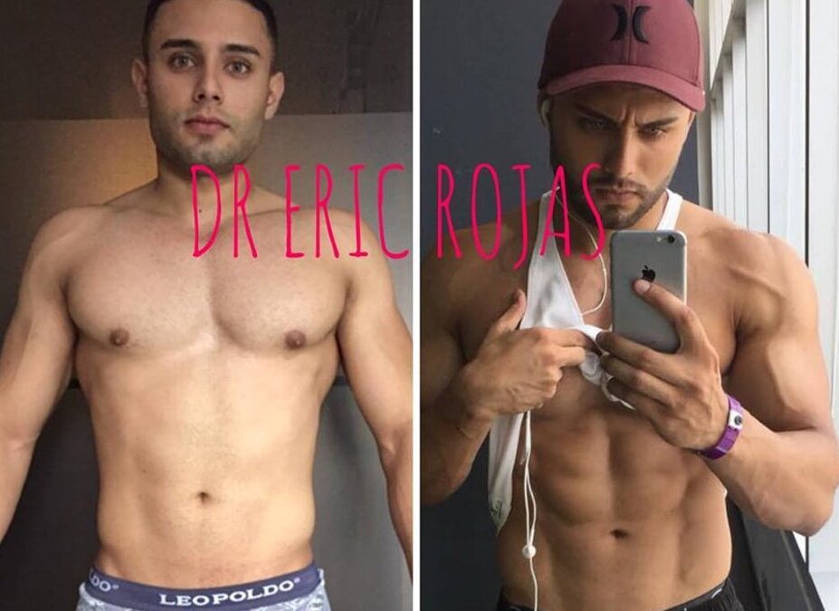 Puedes marcar tu cuerpo con Slim Láser.