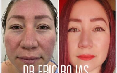 Rejuvenece tu rostro.😉👇