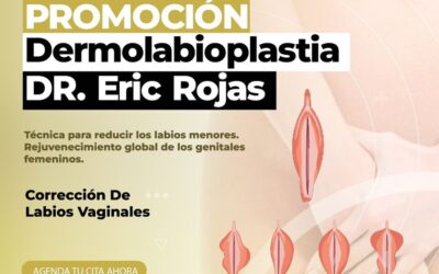 Aprovecha nuestra promoción de dermo labioplastía por solo $950 dólares. 😉👇