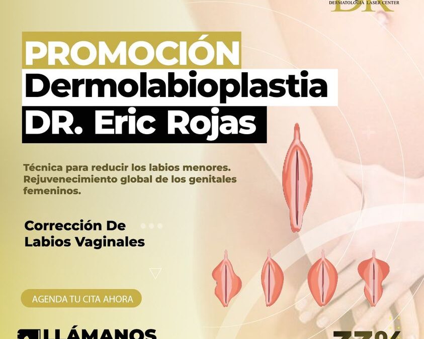 Aprovecha nuestra promoción de dermo labioplastía por solo $950 dólares. 😉👇