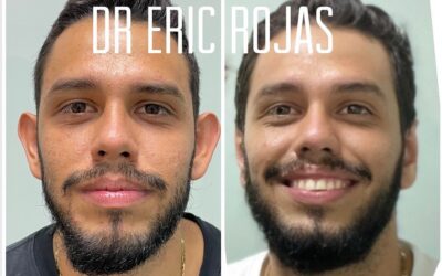Dermo-otoplastia DR ERIC ROJAS 22483535 tan solo 900 dólares