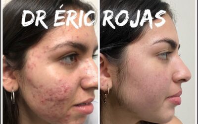Limpia tu rostro con el mejor tratamiento.
