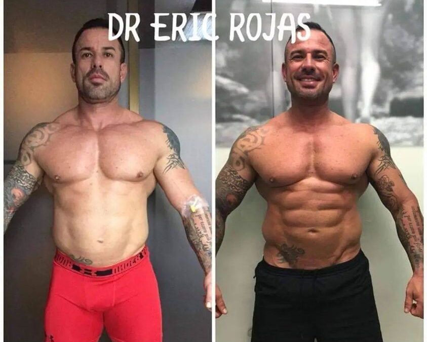 Slim Láser, marca tu cuerpo.