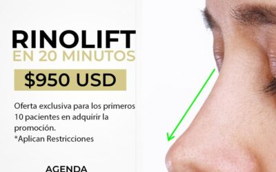 Rinolift es lo mejor para corregir tu perfil, aprovecha la oportunidad.