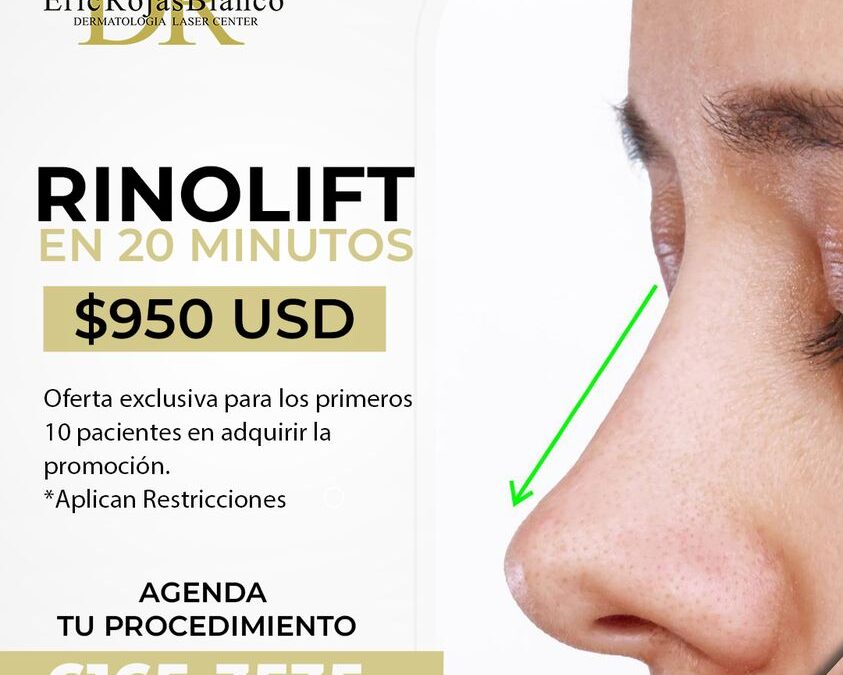 Rinolift es lo mejor para corregir tu perfil, aprovecha la oportunidad.