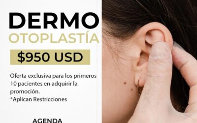Dermo Otoplastía por $950 dólares, aprovecha la oportunidad de corregir tus orejas.