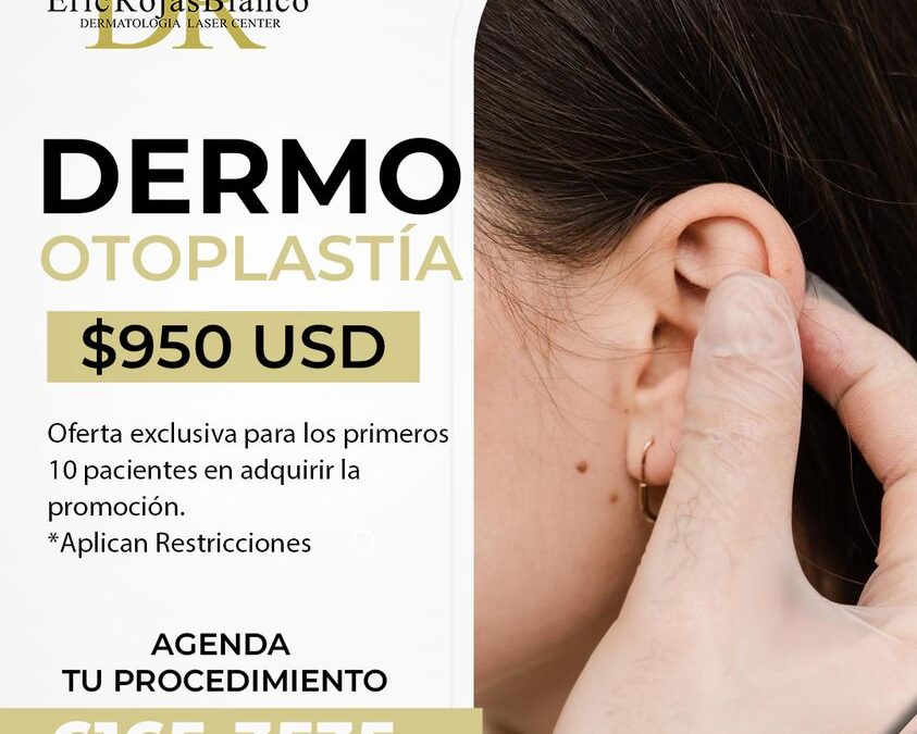 Dermo Otoplastía por $950 dólares, aprovecha la oportunidad de corregir tus orejas.