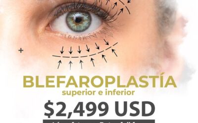 La mejor oferta para que realices tu Blefaroplastia con increíbles regalías.