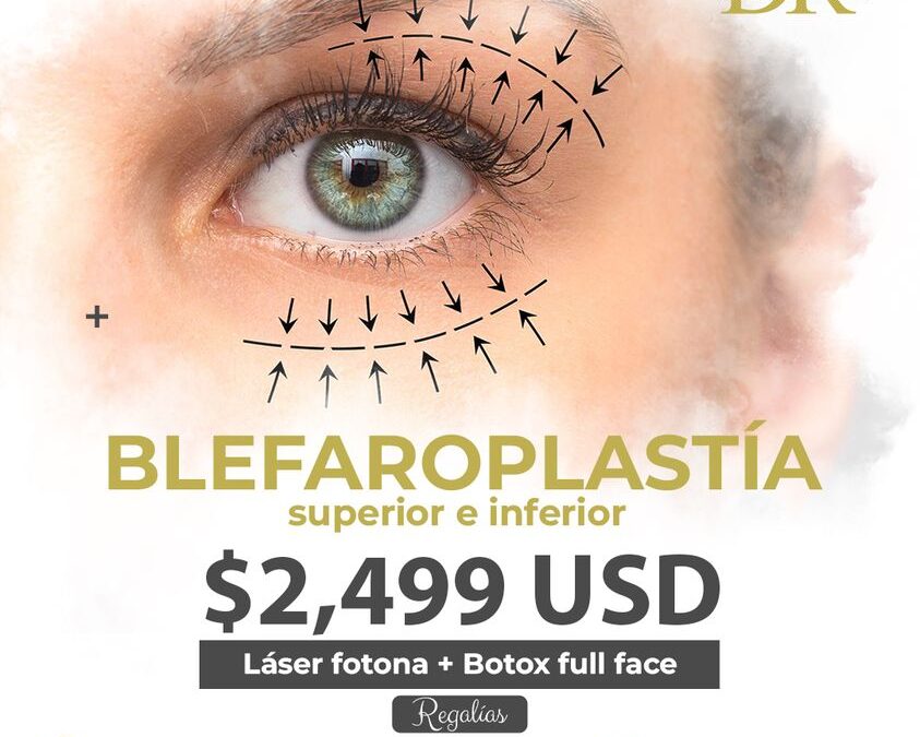 La mejor oferta para que realices tu Blefaroplastia con increíbles regalías.