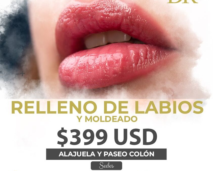 Relleno de labios + moldeado. $399 dólares.