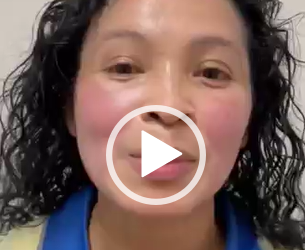 Las manchas de tu rostro si se pueden ir, visítanos.