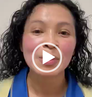 Las manchas de tu rostro si se pueden ir, visítanos.