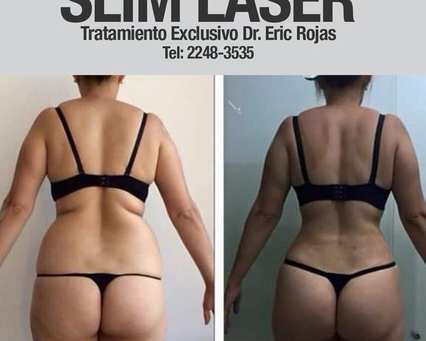 Slim Laser
