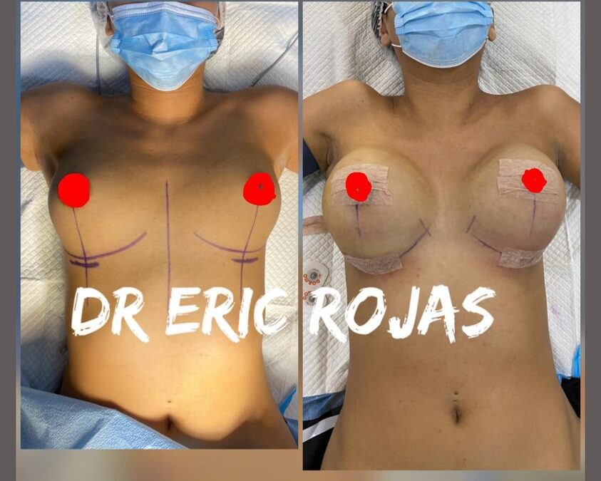 Implantes en promoción, de $2,700 en adelante.