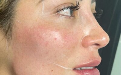 Refrescamiento facial
