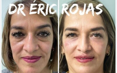 Rejuvenece tu rostro con los métodos más avanzados en refrescamiento facial.
