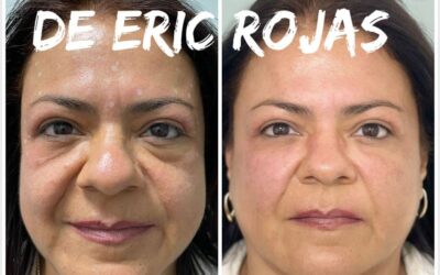 Refrescamiento facial, contamos con las mejores técnicas.