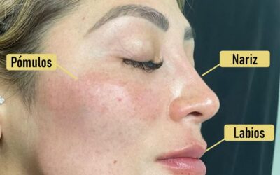Mira este increíble refrescamiento facial.