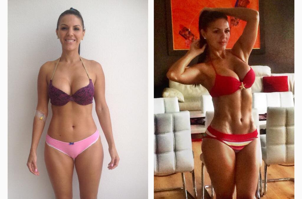 Hermoso y perfecto cuerpo realizado con Slim Láser.