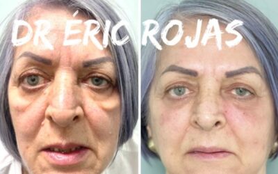 Rejuvenece tu rostro.