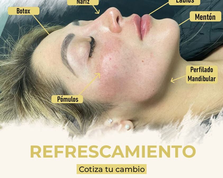Mira este increíble refrescamiento facial, cada paciente requiere de diferentes procedimientos, escríbenos.