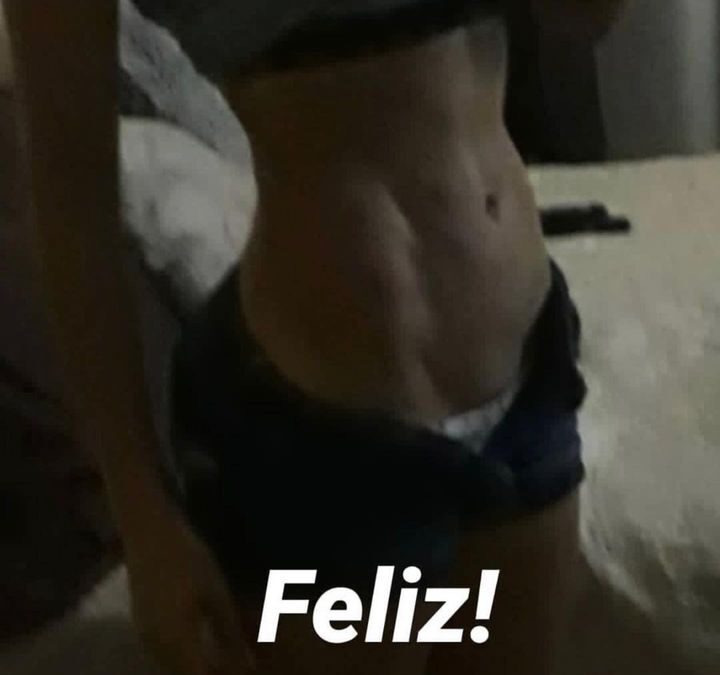 Slim Láser después de 6 años increíble Dr Eric Rojas 22483535