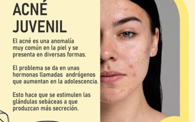 Tratamos el acné juvenil, te esperamos.