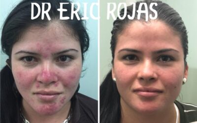 Obtén tu rostro perfecto, con el mejor tratamiento.