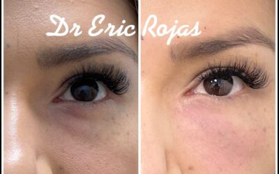 OJERAS YA NO MÁS DR ERIC ROJAS TE LAS MEJORA 22483535